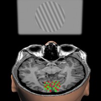 Functional MRI